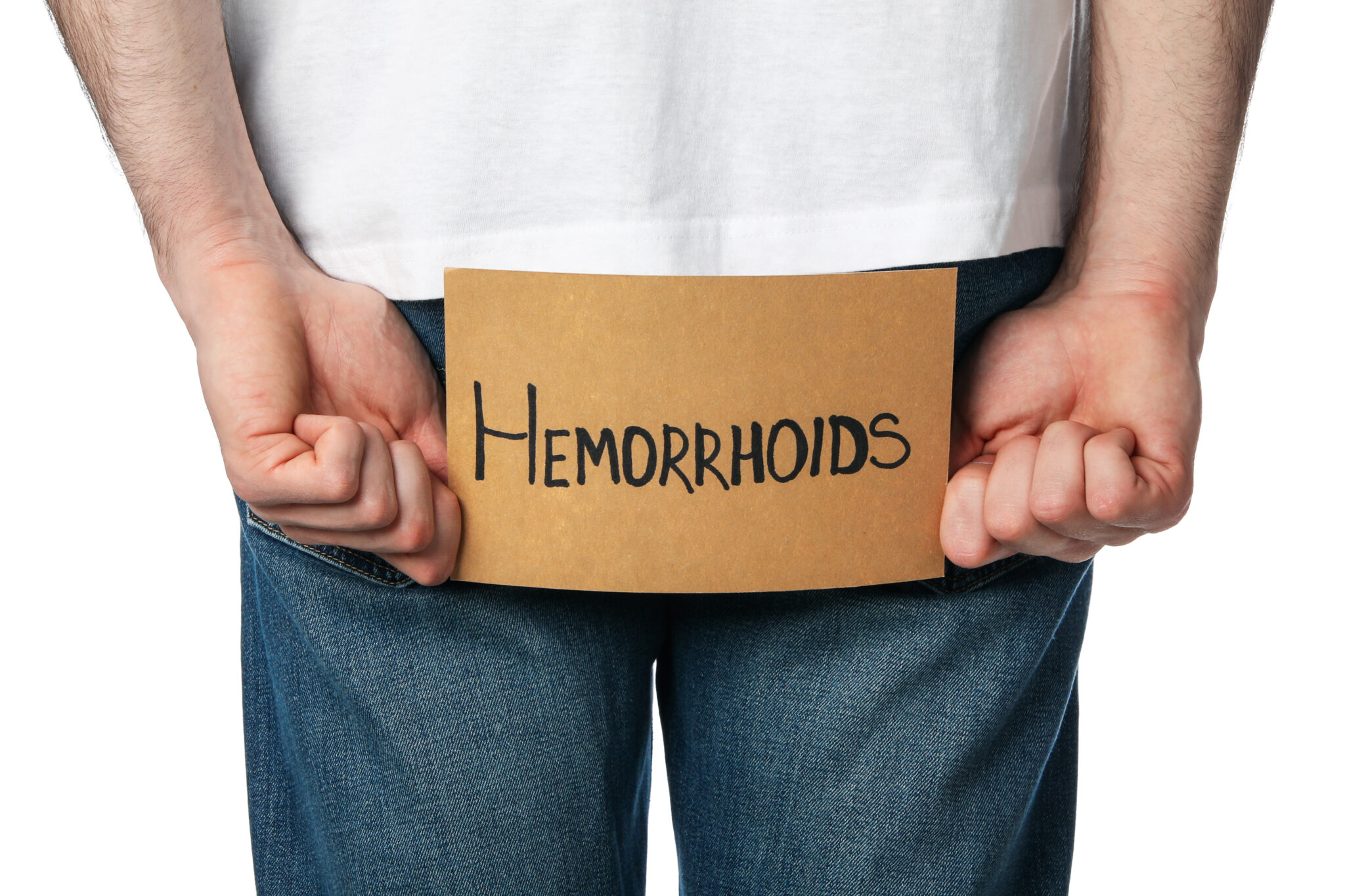 hémorroïdes